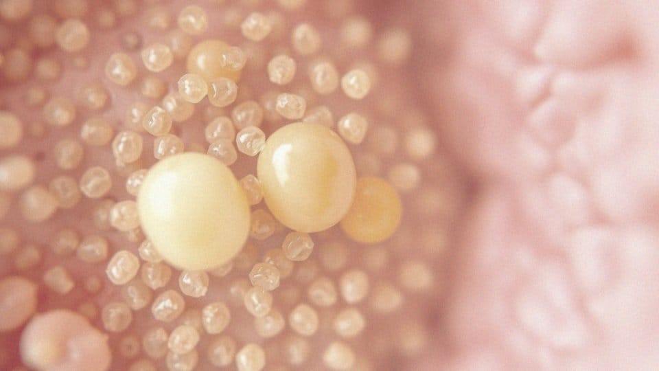 Jak działa drożdże Saccharomyces boulardii w Enterosive?